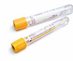 *Bloedbuisjes, SST II Advance Gel en Stollingsactivator, Becton Dickinson