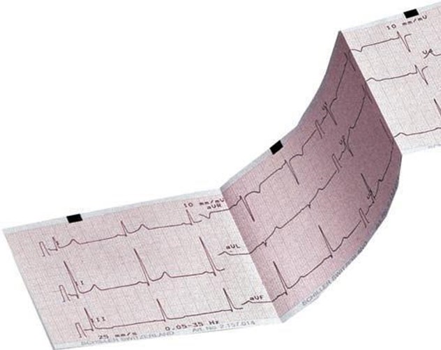 ECG Papier, Cardiosmart Mac 1200