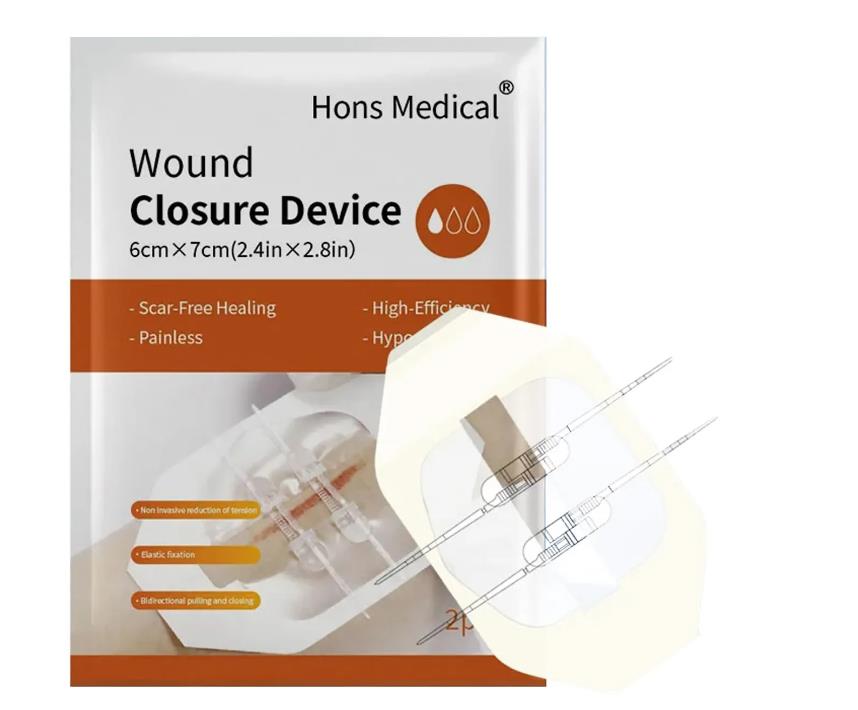 Zip wondsluitingsapparaat G1