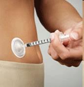 Diabetes, I-port Advance 