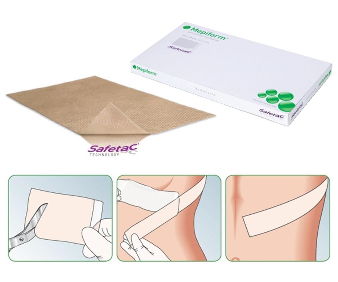 Littekenverband, Mepiform, Adhesive, Steriel, Molnlycke