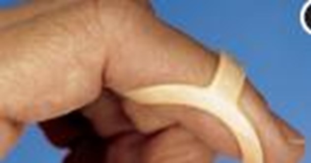 Vingerspalk, Inviduele Ring, Ovaal 8