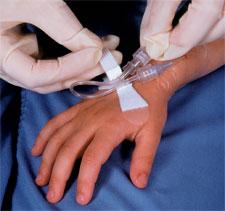 Fixatie Pleisters, Centraal Veneuze Catheter