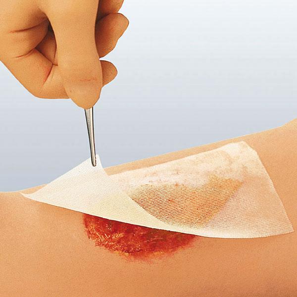 Wondzorg, Zalfgaas, Cuticerin, Steriel, Smith&amp;Nephew