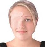 *Oogverband, Niko Eye Fix