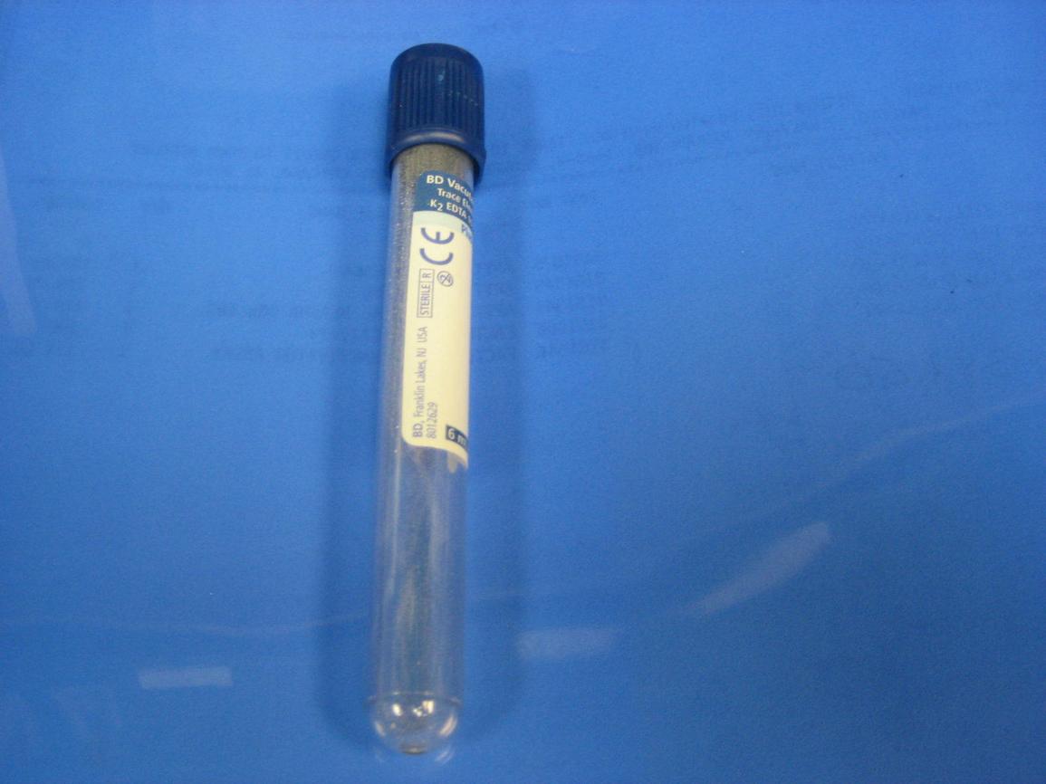 Bloedbuisjes, Trisodium Citrate, Becton Dickinson